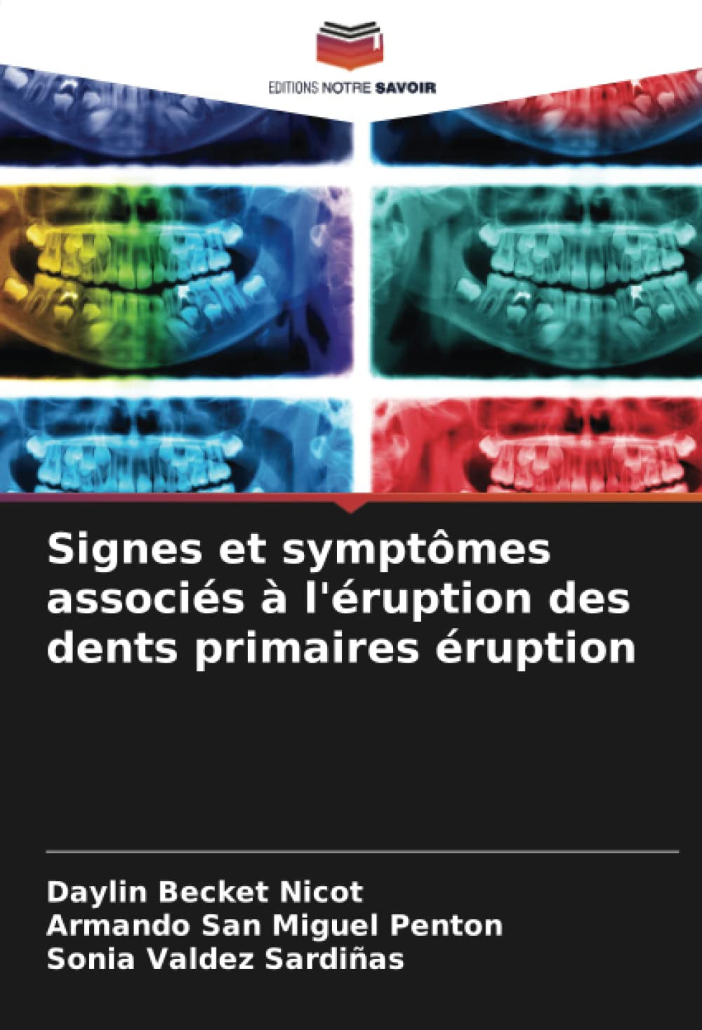 Signes et symptomes associes a l'eruption des dents primaires eruption