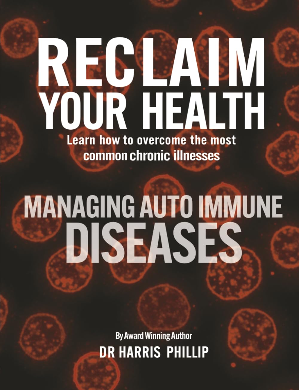 RECLAIM YOUR HEALTH - MANAGING AUTOIMMUNE DISEASES: Learn how to overcome the most common chronic illnesses      Paperback – April 1, 2026