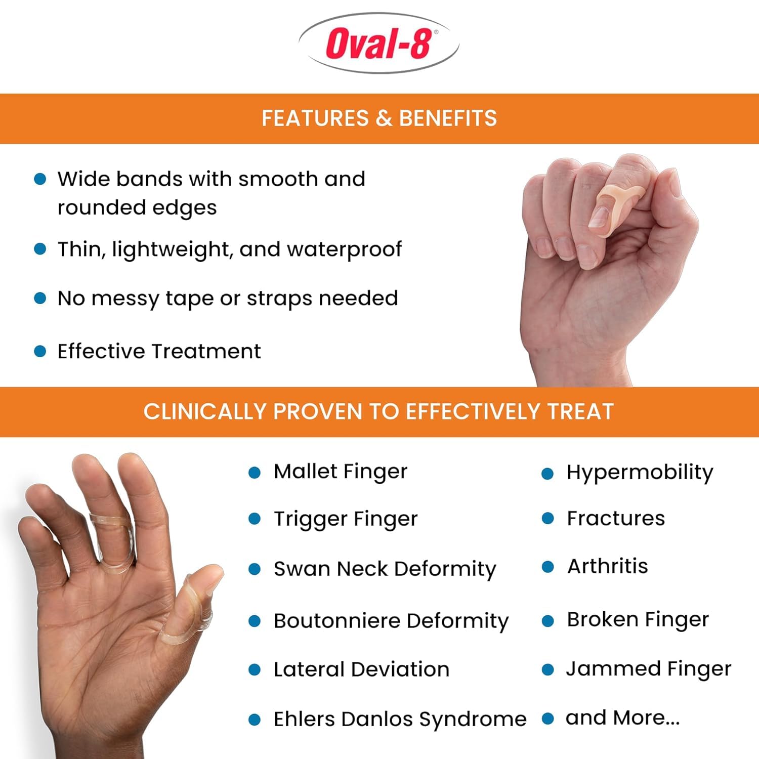 3-Point Products Oval-8 Finger Splints Sizes 8 9 10 Pack of 3 Beige | Support and Protection for Arthritis Trigger Finger or Thumb and Other Finger Conditions product thumbnail 3