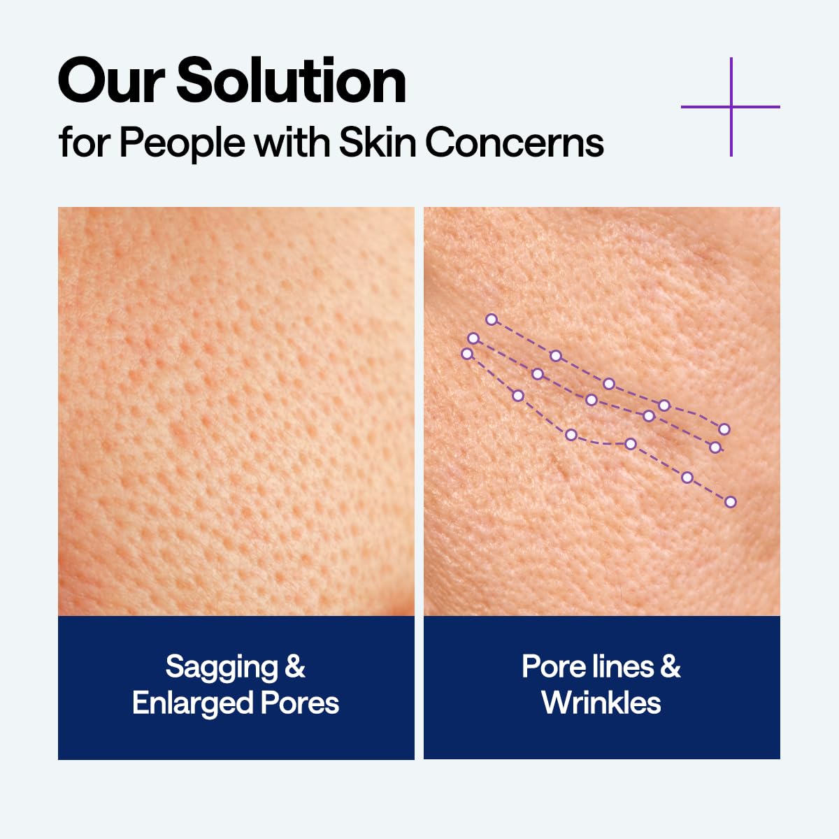 Mediheal PDRN Lifting Serum with Squalane 1.35 fl.oz - Korean Face Serum for Natural Glass Glow Skin, Pore Care & Skin Firming, Deep Moisturization - Image 4