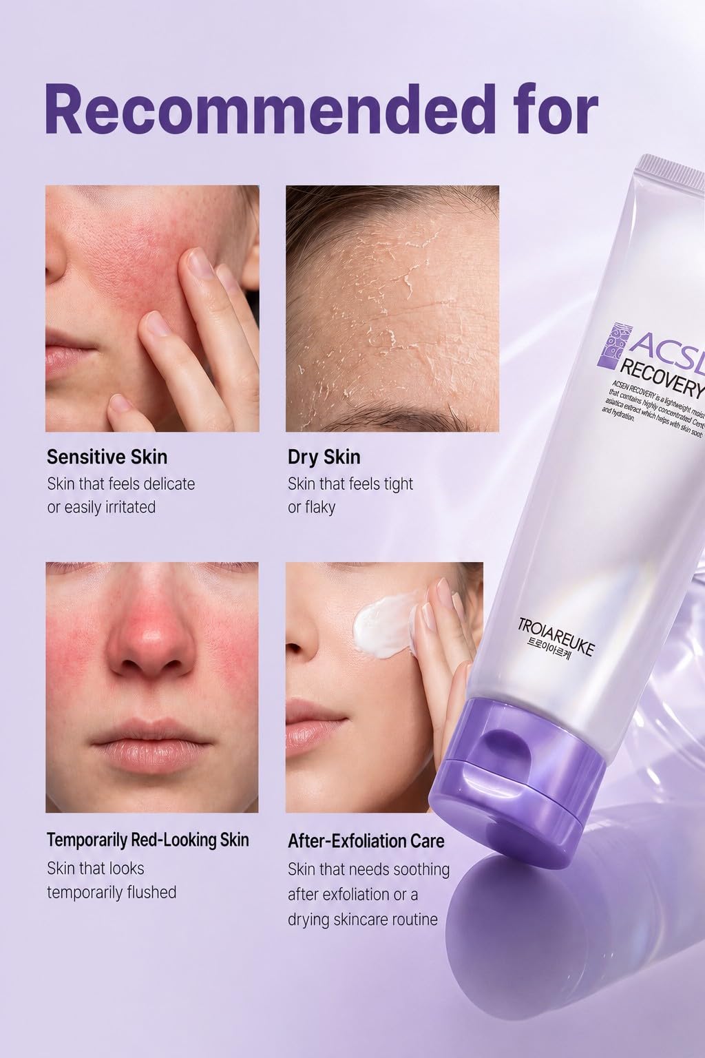 Amazon.com: TROIAREUKE ACSEN Recovery Cream, Skin Barrier