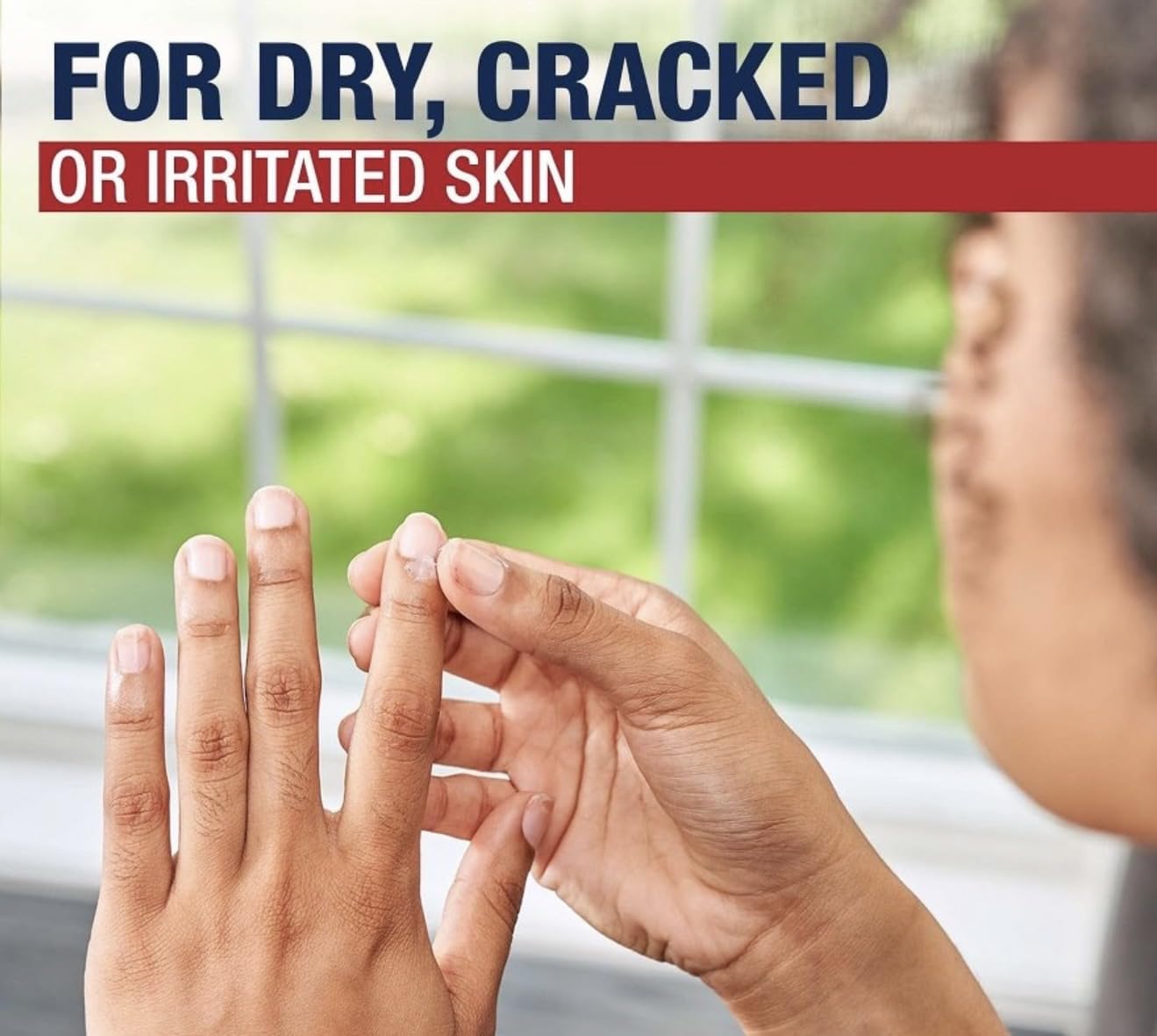 Aquaphor Advanced Therapy Healing Ointment - 14 oz, Pack of 5