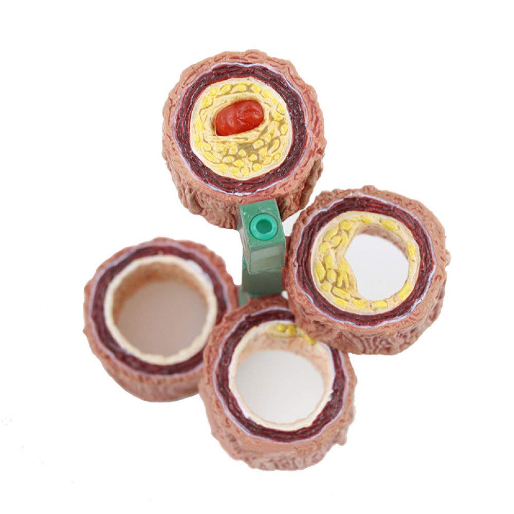 Yuanzhou Vascular Anatomy Atheroma Pathology Cardiovascular Blood Circulation Model For Medical Teaching