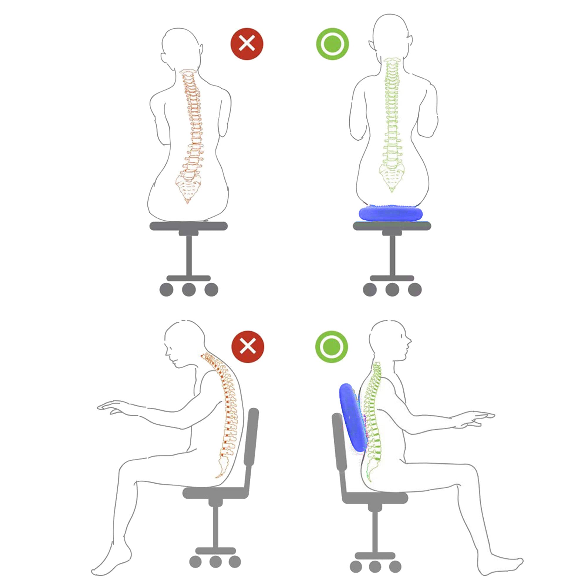 Springos, cuscino per seduta con palla da equilibrio, double face, con gommini a senso, cuscino oscillante con pompa ad aria