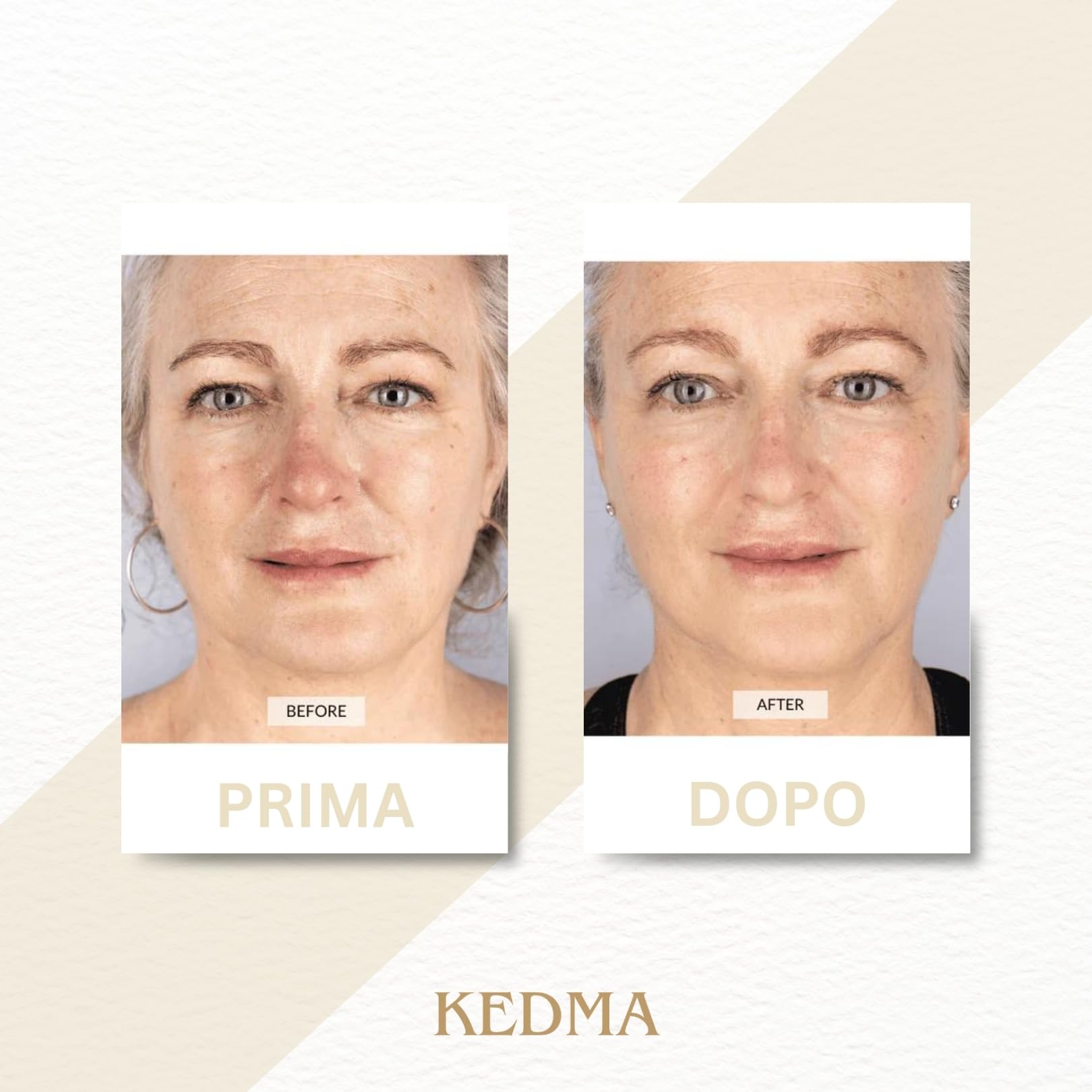 Kedma - Kit Cura Viso con Oro 24K - Tonico, Siero, Crema e Maschera - Anti-Età e Luminosità - 4 Prodotti