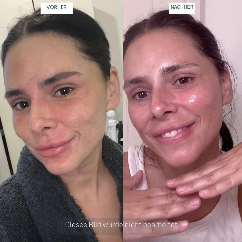 Anti-Aging Gesichtsserum 50ml - Hyaluronsäure, Rosenwasser, Rose Absolue, Hagebuttenkernöl, Glykolsäure - Preisgekrönt - 98% Natürlich, 80% Biologisch