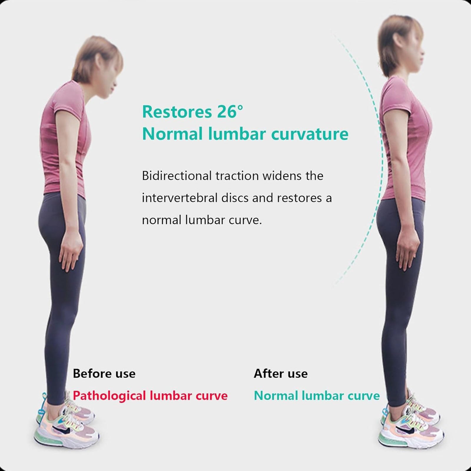 Rückenstrecker Gerät,Inversionsbank Für Das Fitnessstudio,Platzsparende Wirbelsäulenstrecker,Längenverstellbar Back Stretcher,Heimfitness Bauch Und Rückentrainer