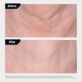 Revision Skincare Nectifirm, Anti Aging Neck Firming Cream for Reducing Fine Lines, Wrinkles and Crepey Skin, 8 oz