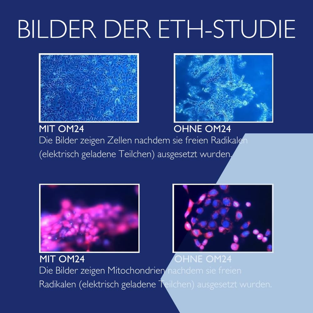 OMNIMEDICA Novigel Anti-Aging Creme – Gegen Pigmentflecken, Narben, Falten & Altersflecken – Gesichtspflege mit OM24® für Damen & Herren – vegan, natürlich & Swiss Made – 150ml
