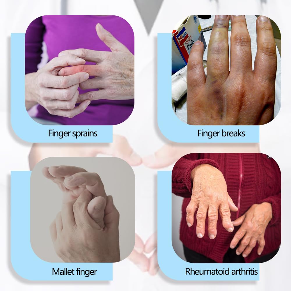EDWERD Finger Straightener Splint Joint Extension Brace Corrector for PIP Joint Tightness, Arthritis, Trigger Finger, Deformity & Rehabilitation Support