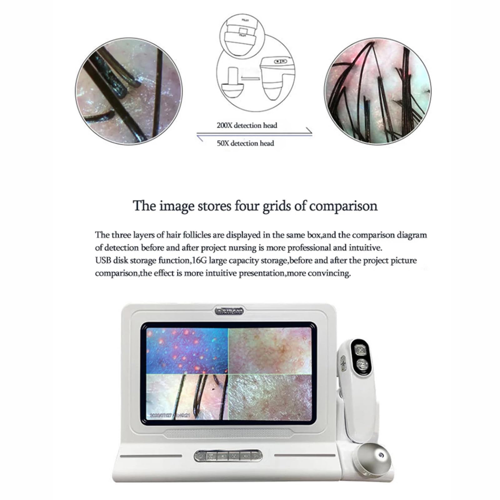 Analizador de cuero cabelludo y piel LCD profesional de 11 pulgadas, Detector de microscopio Digital, lupa, Detector de cuero cabelludo y espinillas