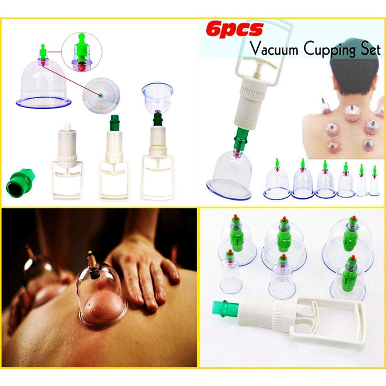Massager Can Cupping Kit 4