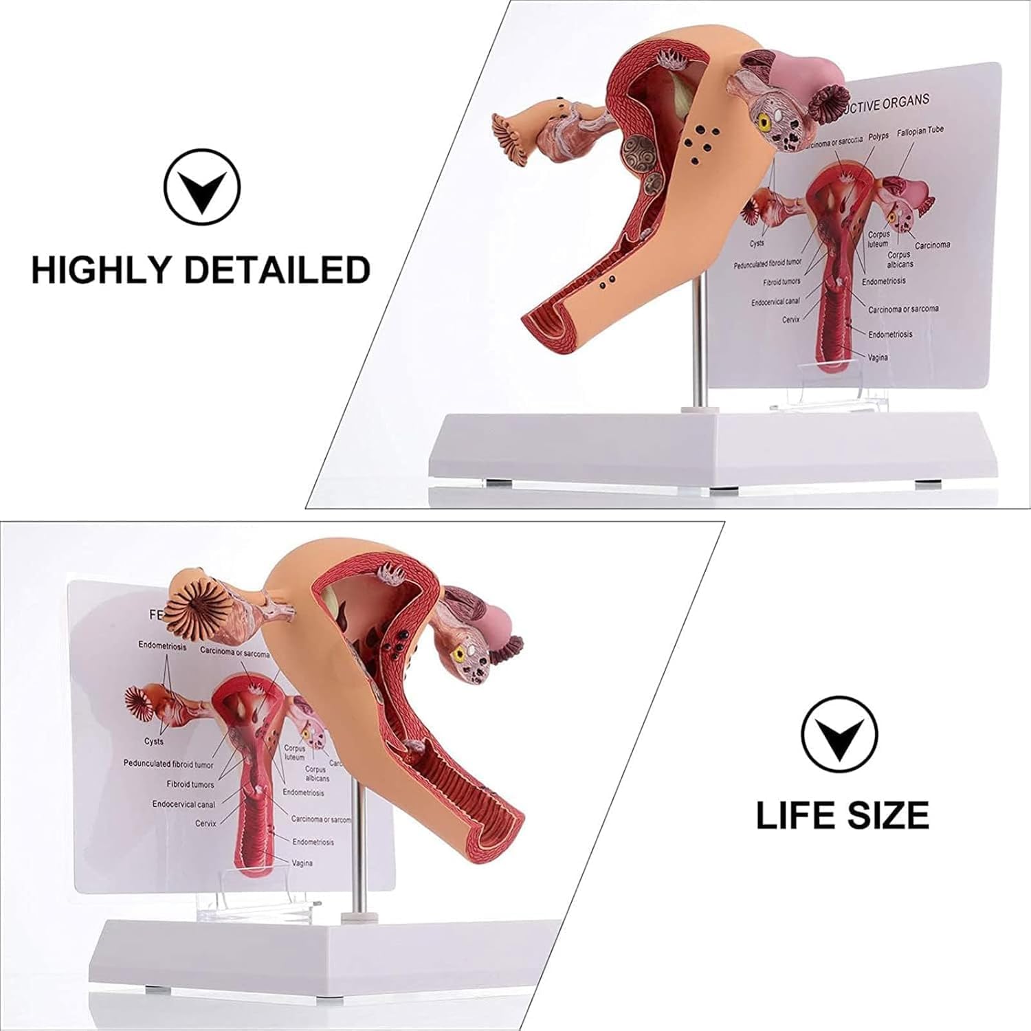 Modello del sistema riproduttivo femminile umano - Modello 3D di anatomia dell'utero e dell'ovaio per insegnamento e apprendimento, strumento educativo per studenti e professionisti sanitari