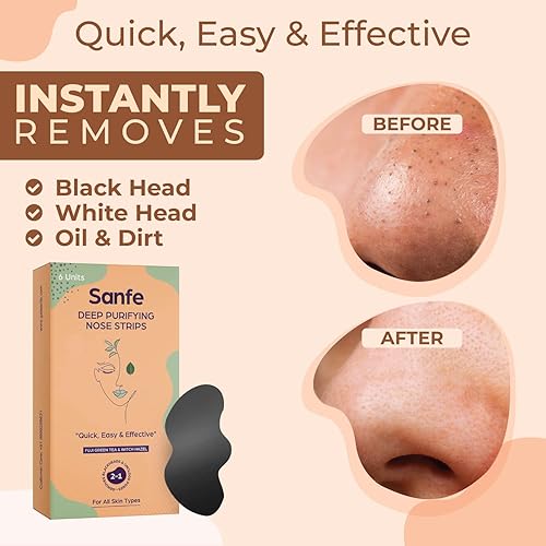 Miniatura 2 de Tiras nasales purificadoras profundas para mujer, paquete de 6 con extractos de té verde Fuji y hamamelis, elimina puntos blancos, puntos negros y
