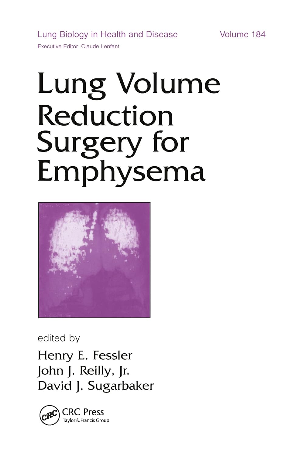 Lung Volume Reduction Surgery for Emphysema 184 Buy Online at Best