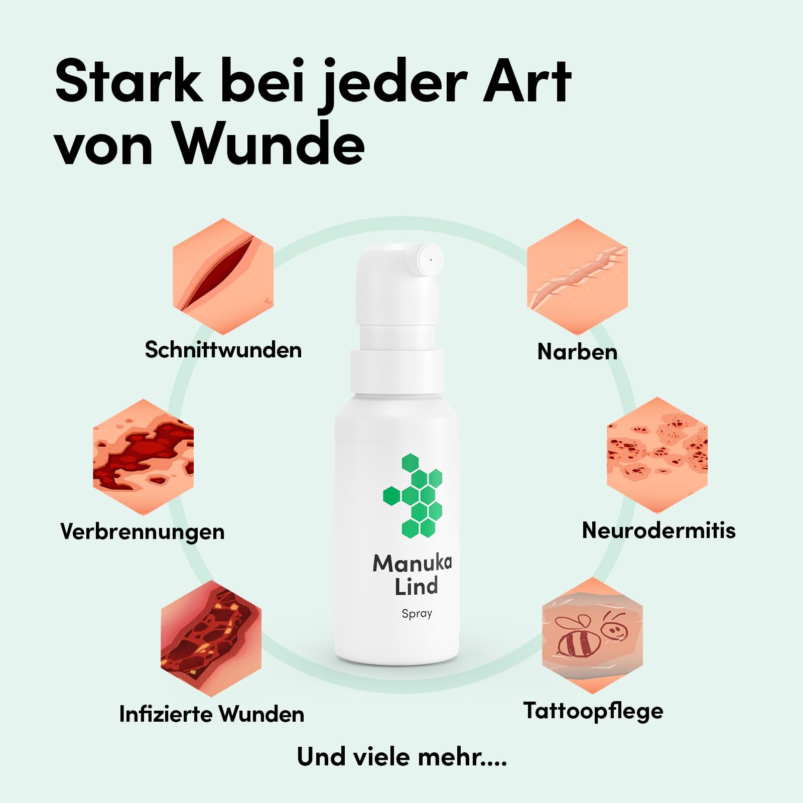 Wundheilspray 2x30ml - mit Manuka-Honig MGO 514+