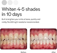 Vista 4 de Opalescenc 4648-1 - Bandejas blanqueadoras de dientes prellenadas – Original 15% – (4 tratamientos) – Peróxido de hidrógeno con PF – Cool Mint