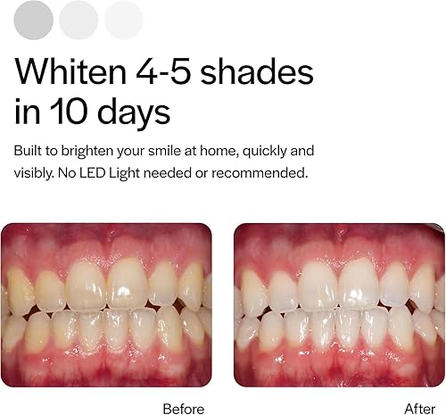 Miniatura 4 de Opalescenc 4648-1 - Bandejas blanqueadoras de dientes prellenadas Original 15% (4 tratamientos) Peróxido de hidrógeno con PF Cool Mint