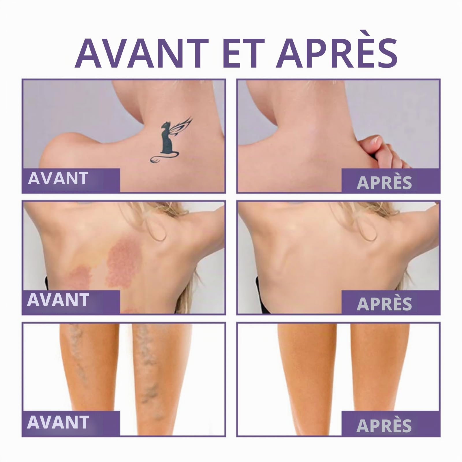 MIRACLEDE PARIS Body Perfector,Correcteur Corps Entier Etanche,Anti-Transfert,Camoufle Veines,Cicatrices et Tatouages,Texture Légère pour Peau Naturelle
