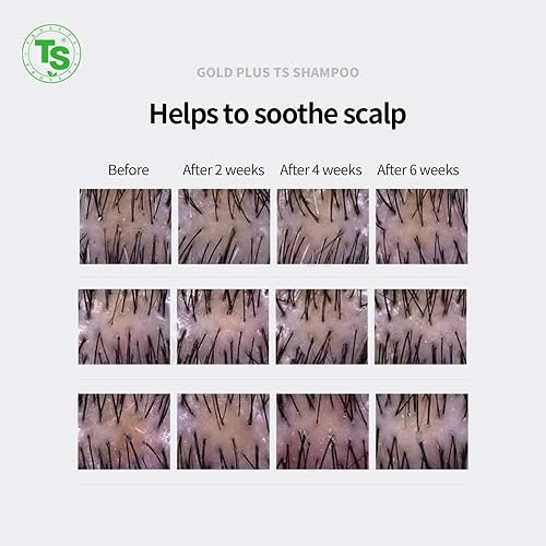 Miniatura 4 de Gold Plus TS Champú para el crecimiento y grosor del cabello (16.9 onzas líquidas) Ingredientes de biotina dorada de lujo | Para cabello dañado,