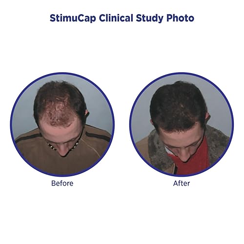 Miniatura 6 de MD Paquete de champú y acondicionador revitalizante (juego de 211.0 fl oz cada uno)  Champú y acondicionador hidratante hidratante para el cabello