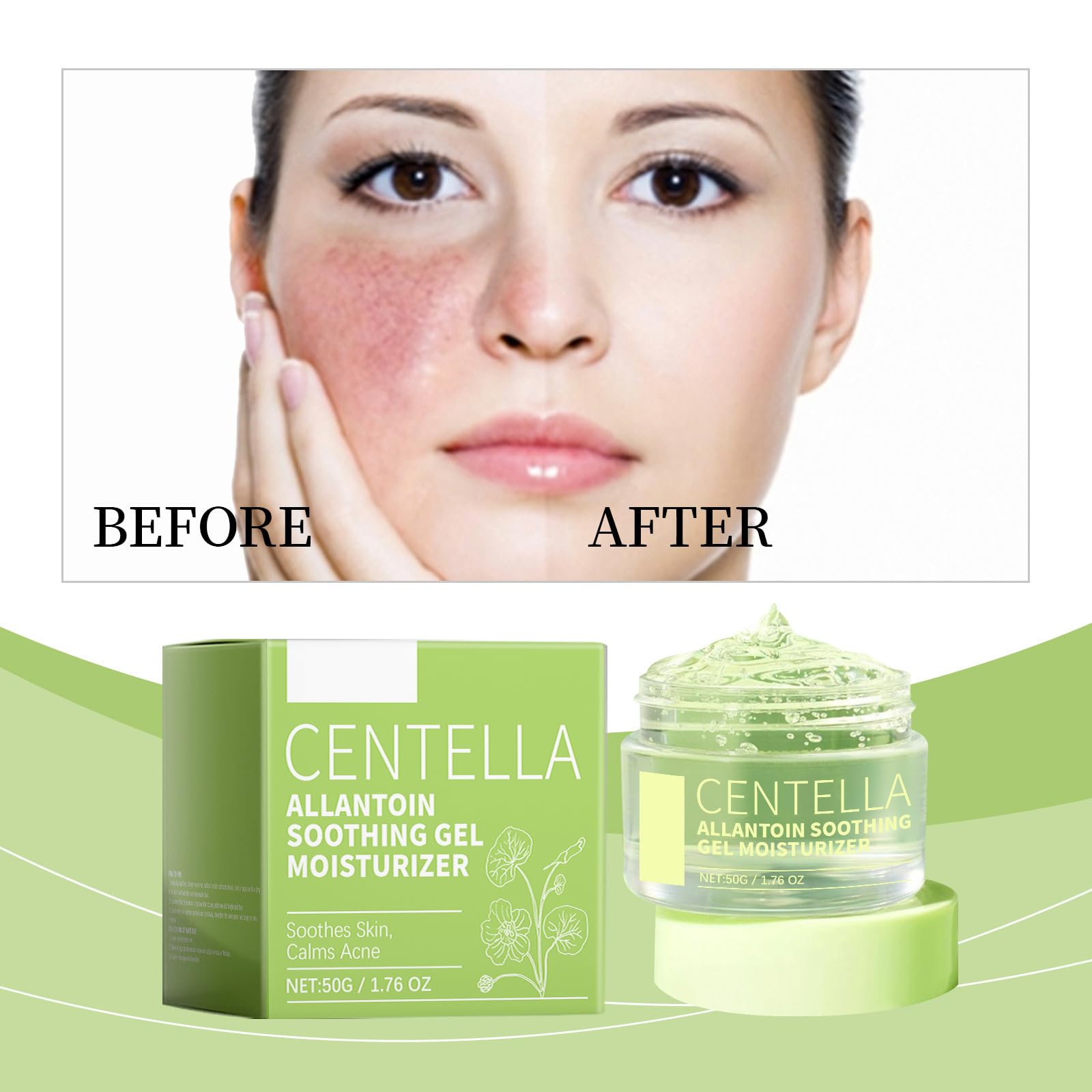 Glad2Glow Centella Allantoin Beruhigendes Gel-Feuchtigkeitscreme Ohne Alkohol Duft & Öl Beruhigendes und feuchtigkeitsspendendes Gesichtsgel für alle Hauttypen 1 Stück YbD013 (Green, 5x5x4.1cm)