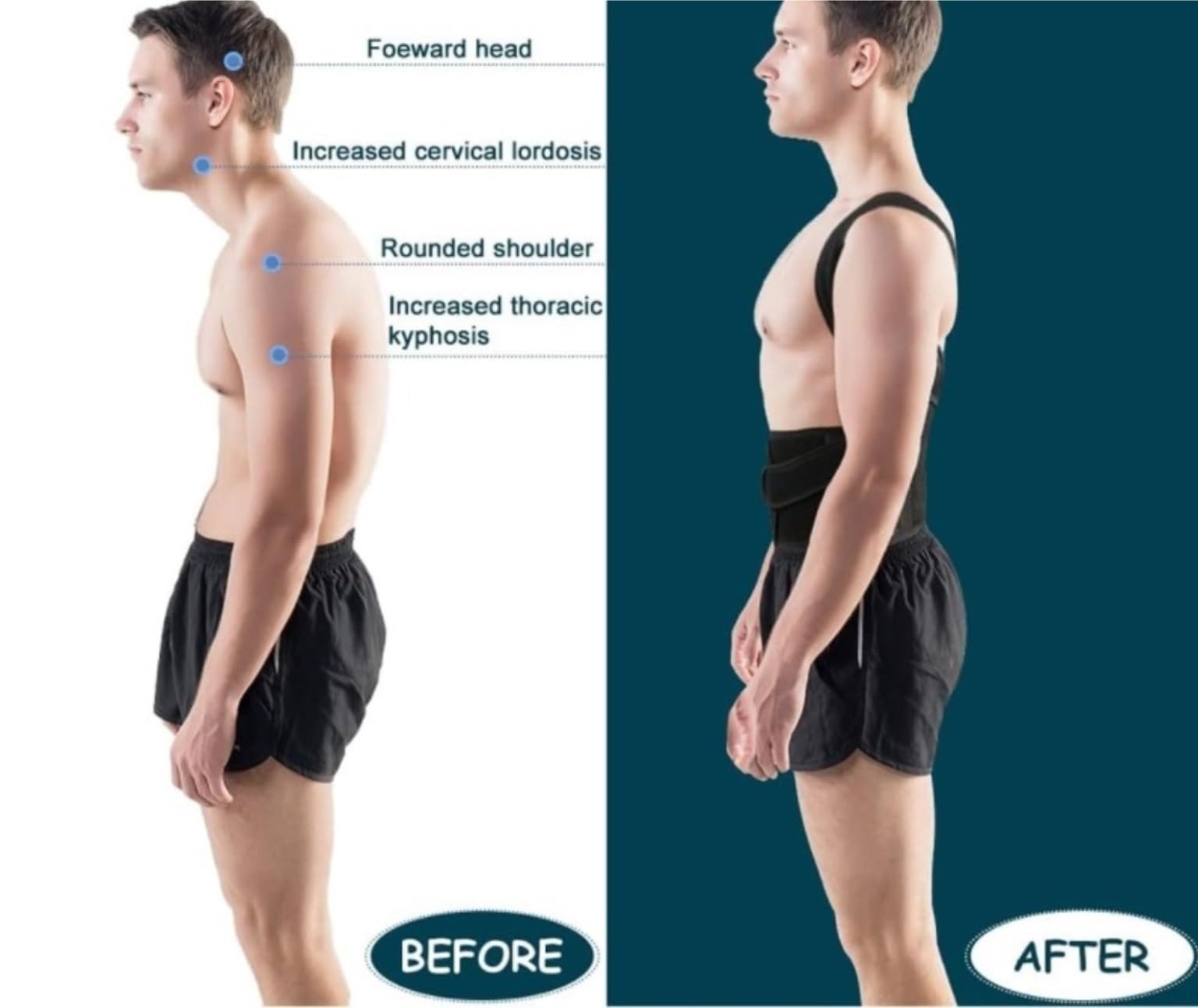 Faja Lumbar Corrector De Postura De Espalda Ajustable, Soporte para Cuello, Clavícula, Hombros Y Espalda, Corrección De Joroba Cinturón Apoyo Lumbar(S)