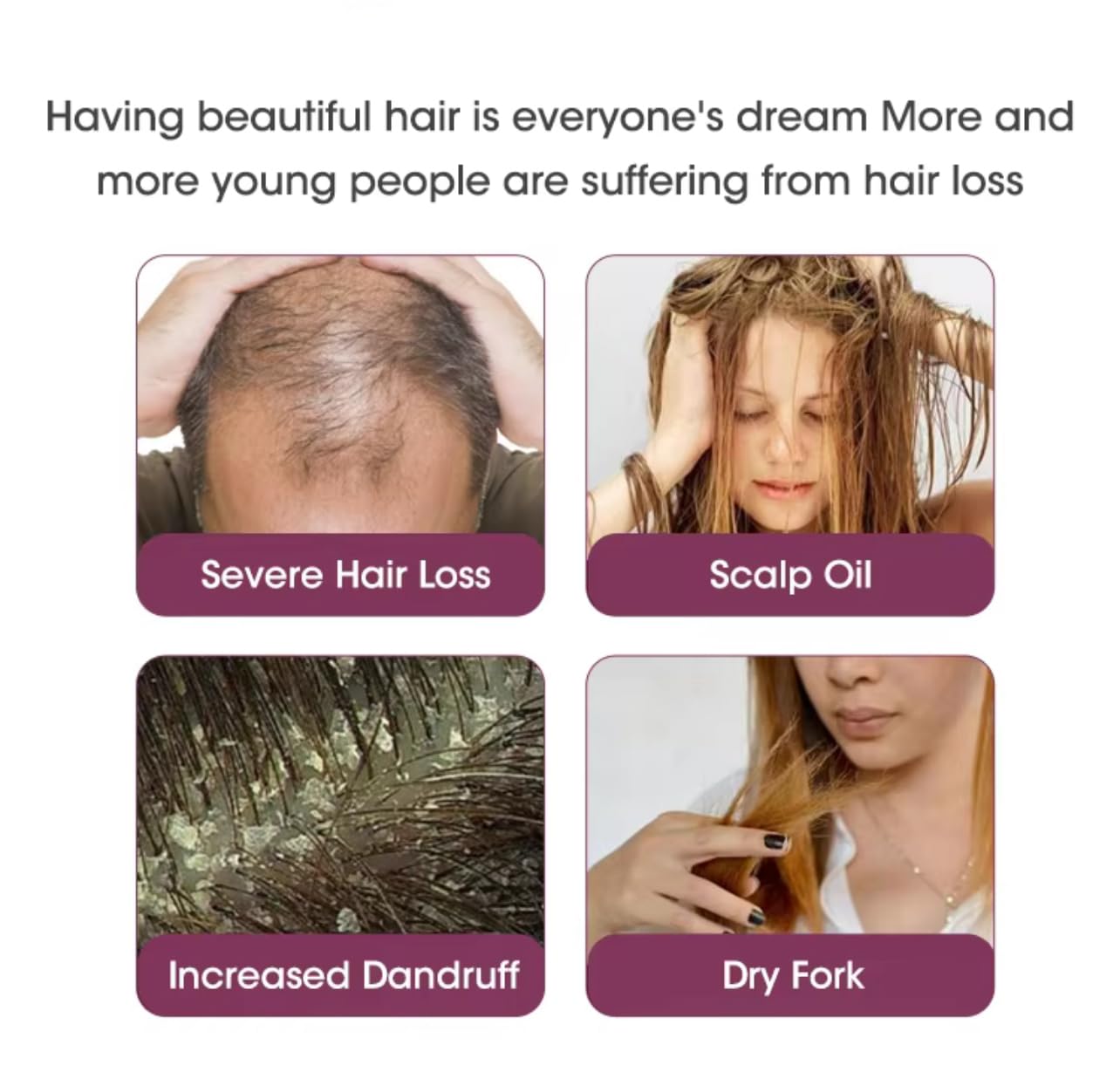 Red Onion Anti-Hair Loss Shampoo, Conditioner and Hair Mask Set, Natural Organic Herbal Formula with Black Seed Oil, 16.9 fl oz for all hair types, prevents hair loss.
