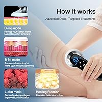 Vista 3 de Masajeador para celulitis y grasa removedor de estrías Quemador De Grasa Abdominal