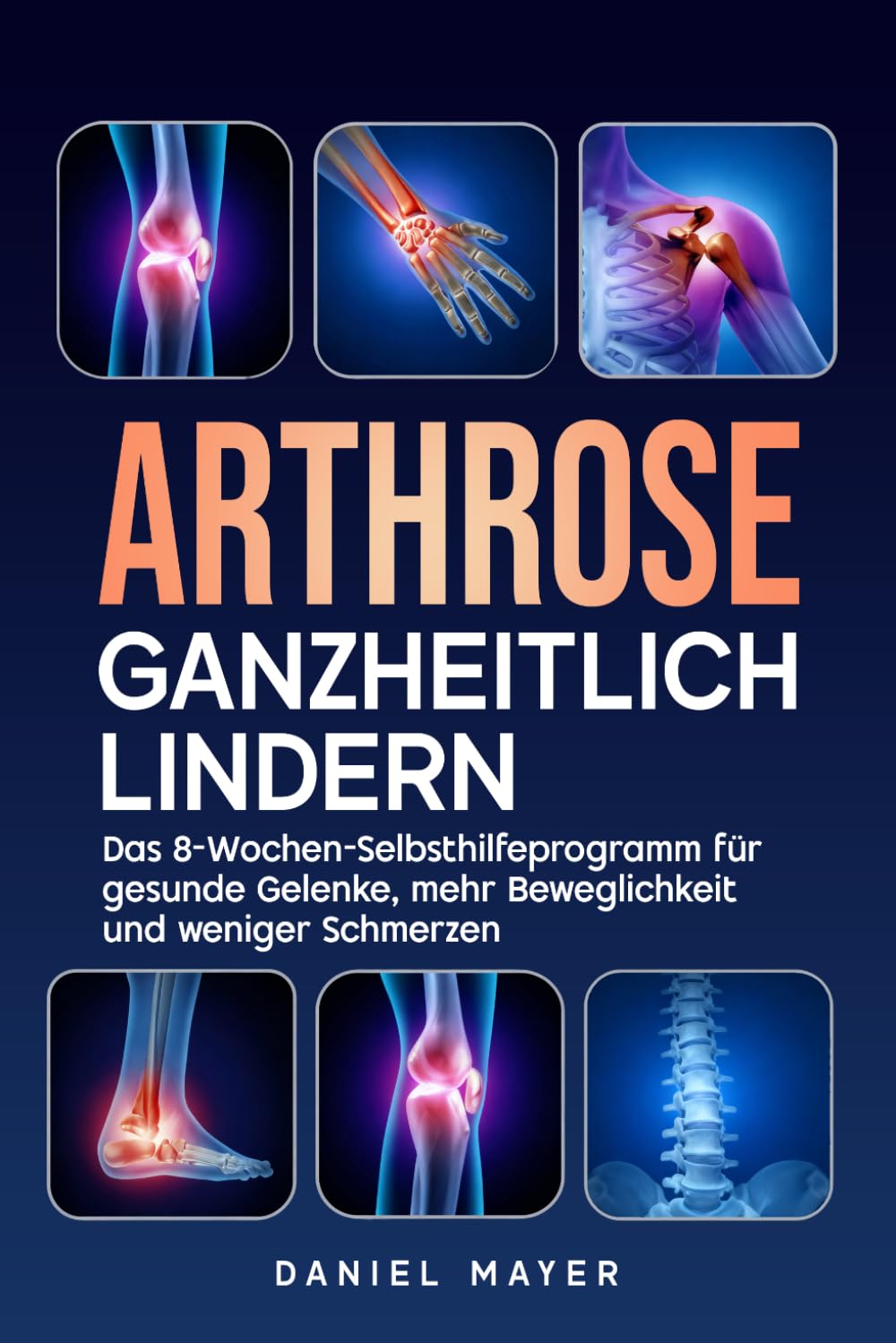 Arthrose ganzheitlich lindern: Das 8-Wochen-Selbsthilfeprogramm für gesunde Gelenke, mehr Beweglichkeit und weniger Schmerzen