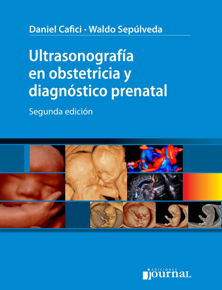 ULTRASONOGRAFIA EN OBSTETRICIA Y DIAGNOSTICO PRENATAL