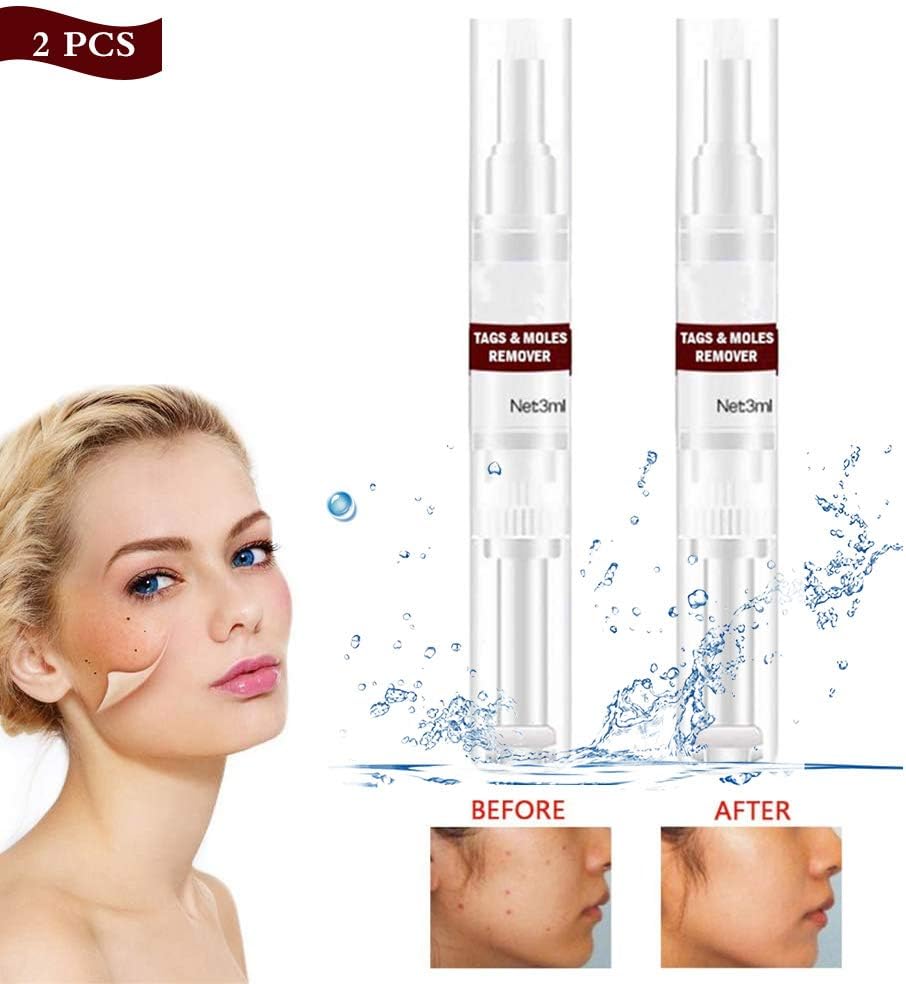 rimozione indolore delle verruche