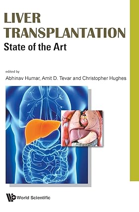 LIVER TRANSPLANTATION: STATE OF THE ART