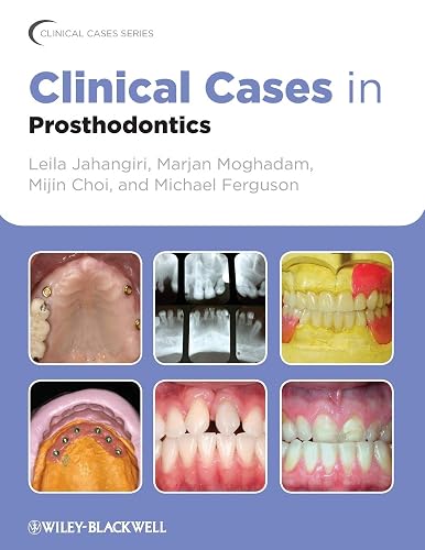 Clinical Cases in Prosthodontics (Clinical Cases (Dentistry))