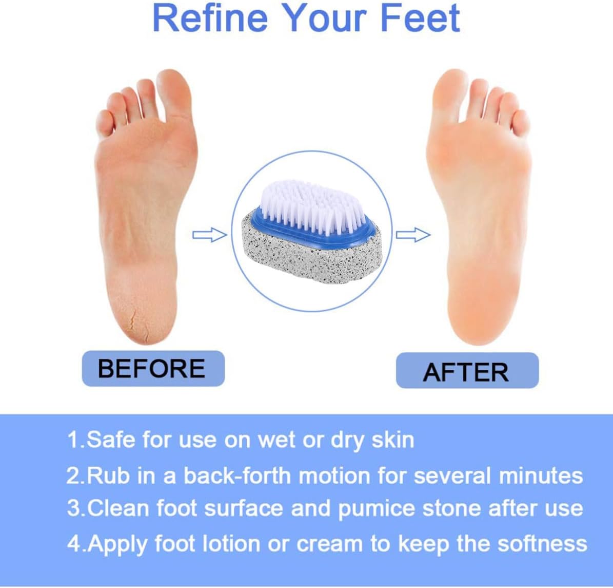 LABRIMP 6pcs Foot Callus Scrubber and Dead Skin Remover with Double Sided Pumice Stone and Plastic Handle, Safe Pedicure Tool for Smooth Feet and Heels Random Color