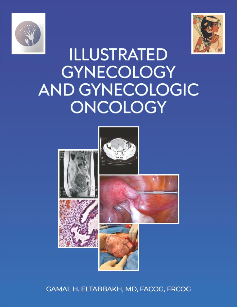 Illustrated Gynecology & Gynecologic Oncology