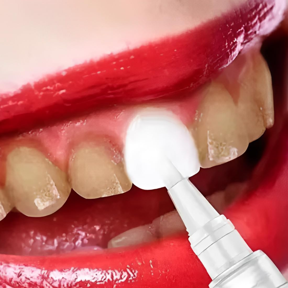 2 Pezzi Penna Sbiancante Denti, Penna Sbiancante per Denti, Sbiancamento rapido&Efficacia, delicato e paradenti per Denti Bianchi, Rimuove le Macchie Dentali