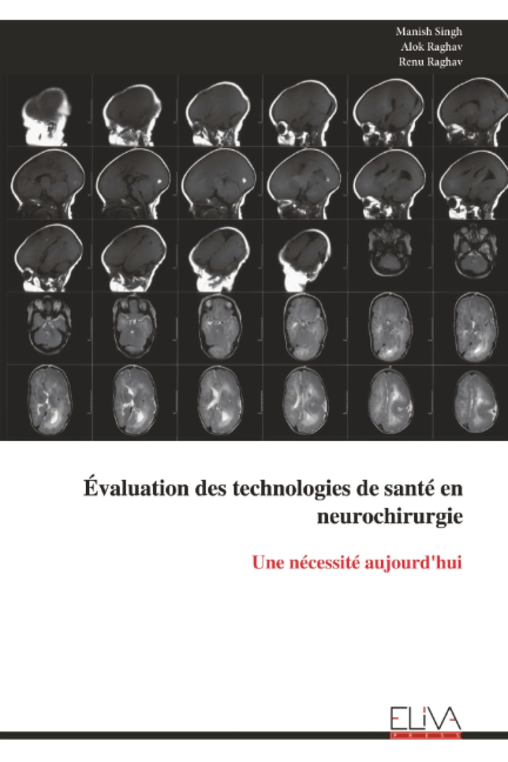 Évaluation des technologies de santé en neurochirurgie: Une nécessité aujourd'hui
