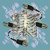 Mexico City Is Sinking