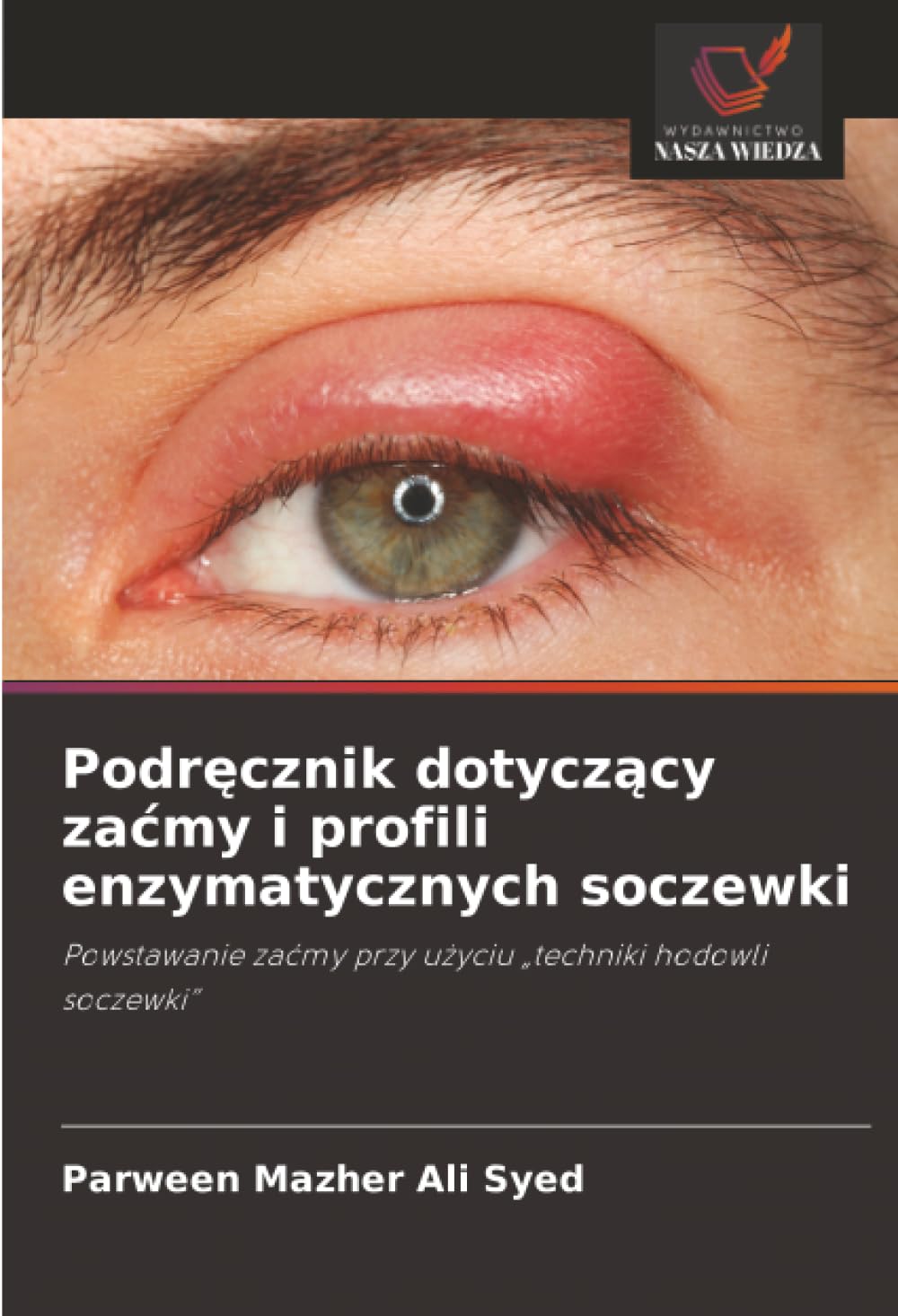 Podręcznik dotyczący zaćmy i profili enzymatycznych soczewki: Powstawanie zaćmy przy użyciu „techniki hodowli soczewki”: Powstawanie za¿my przy u¿yciu "techniki hodowli soczewki"