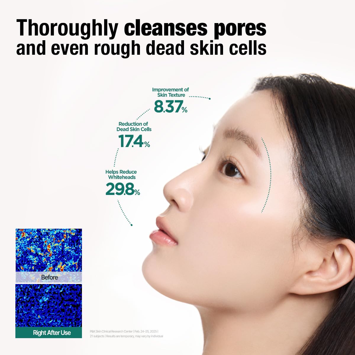 DERMATORY Salicylic™ Pore Cleansing Clay Foam | Deep Purifying for Facial Oil, Sebum, Dead Skin Cells, Whiteheads & Blackheads | Gentle Exfoliating Korean Face Wash for Sensitive | 5.07 fl. oz. - Image 7