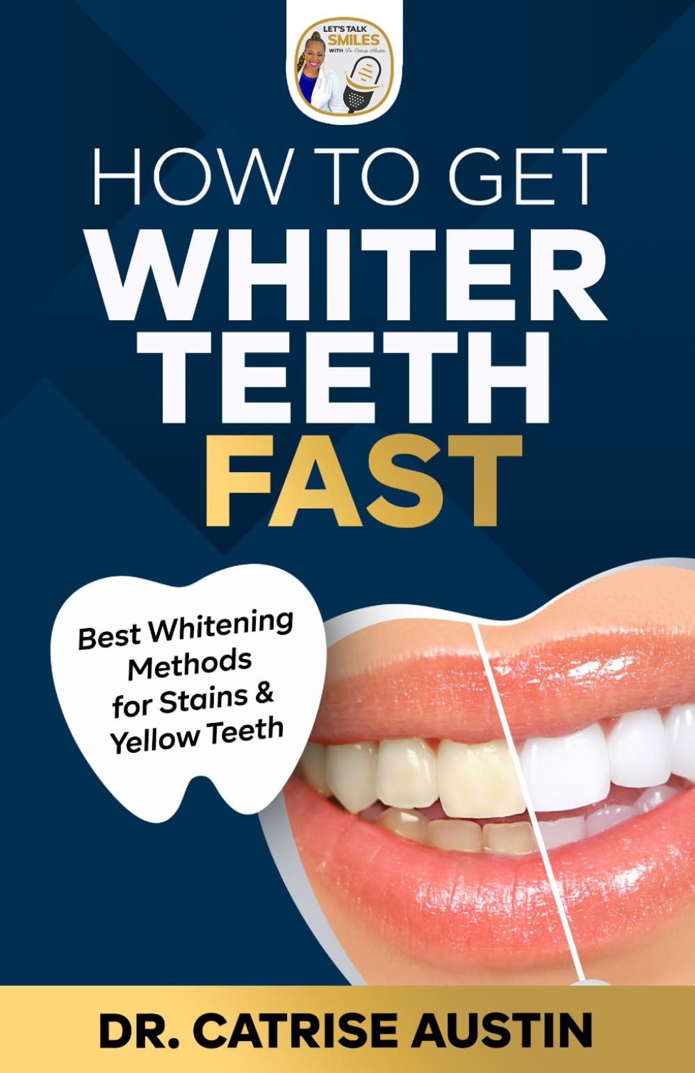 How to Get Whiter Teeth Fast: Best Whitening Methods for Stains & Yellow Teeth (Let’s Talk Smiles: The Podcast Book Series)