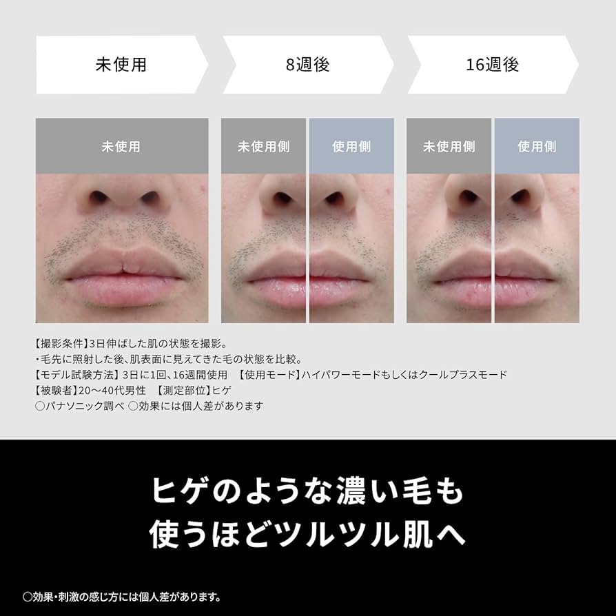 Panasonic 脱毛器 ES-WG0B-H サングラスセット 概要 スムースエピ パワー＆クール ES-WG0B | ボディケア（光