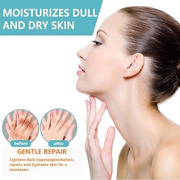 Spot Remover For Body,Spot Corrector Cream,- Underarm, Neck, Armpit, Knees, Elbows, Private Areas, Intimate Areas (Acanthosis Nigricans 1Box)