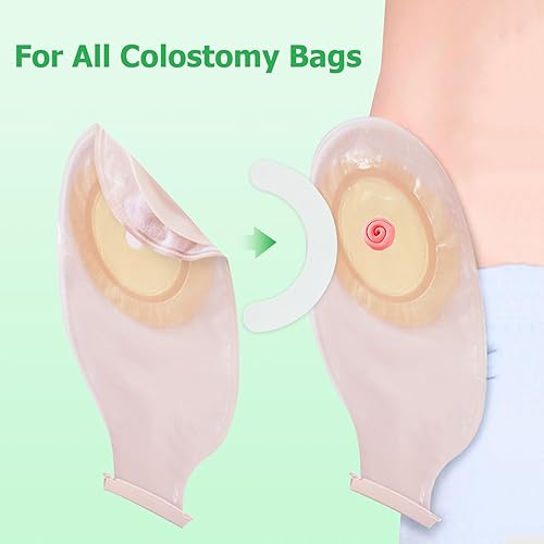 Miniatura 4 de 20 tiras de barrera para ostomía ZnnaYoha (no tejidas, 20 unidades)