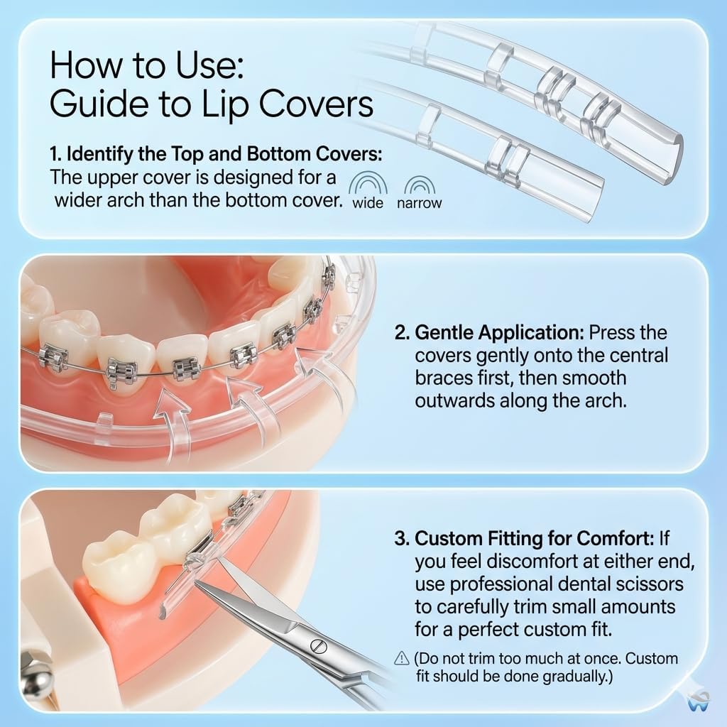 Comfort Covers for Braces - Orthodontic Mouth Guard, Lip Protector, Wax Alternative, Lip Shield for Brackets