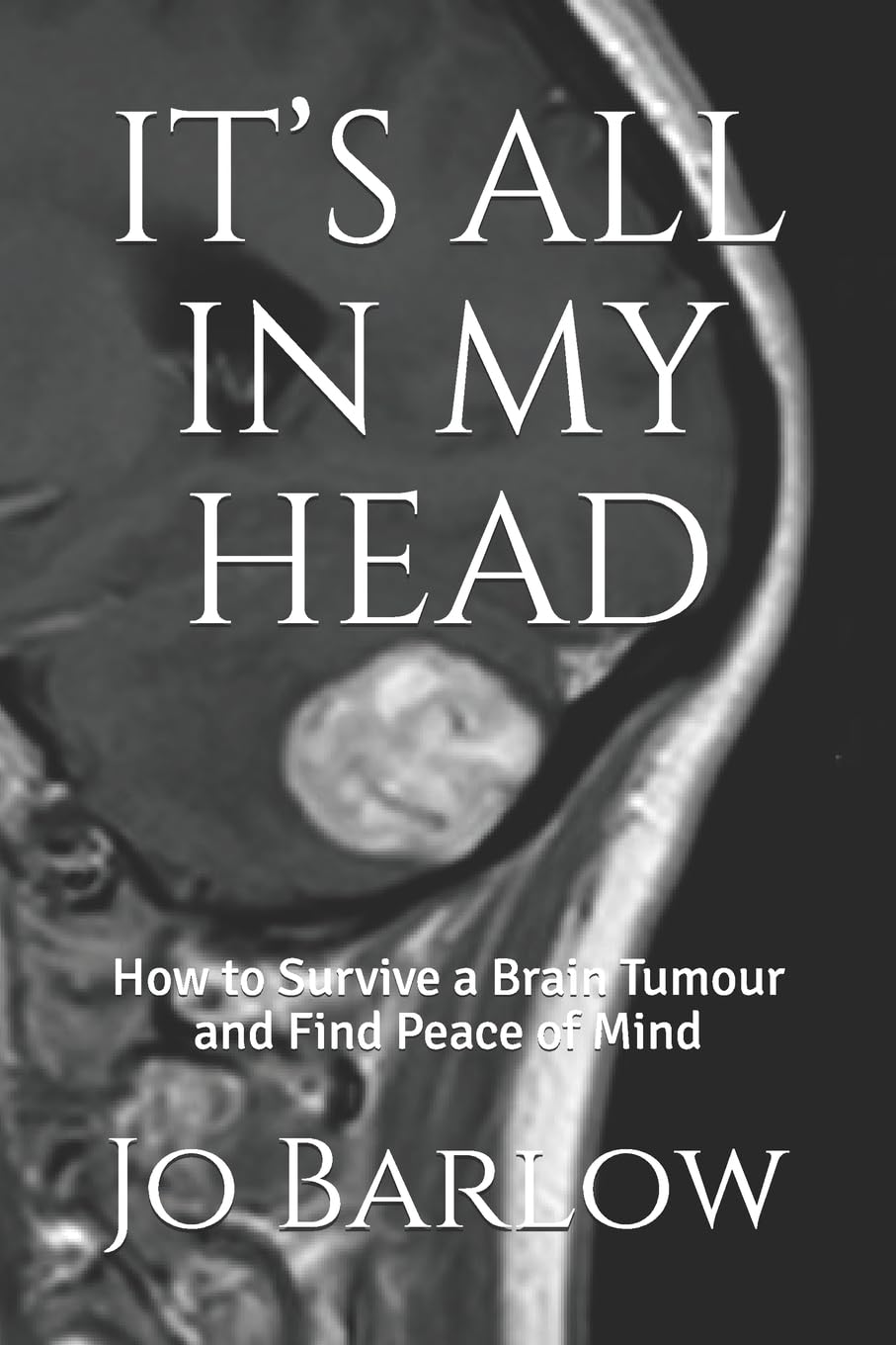 IT’S ALL IN MY HEAD: How to Survive a Brain Tumour and Find Peace of Mind