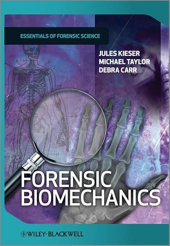 Forensic Biomechanics (Developments in Forensic... 1119990114 Book Cover