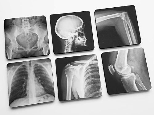 Miniatura 2 de Radiologist Gift Coasters Set of 4 or 6 Xray Radiology Technician Graduation Gift Doctor Nurse