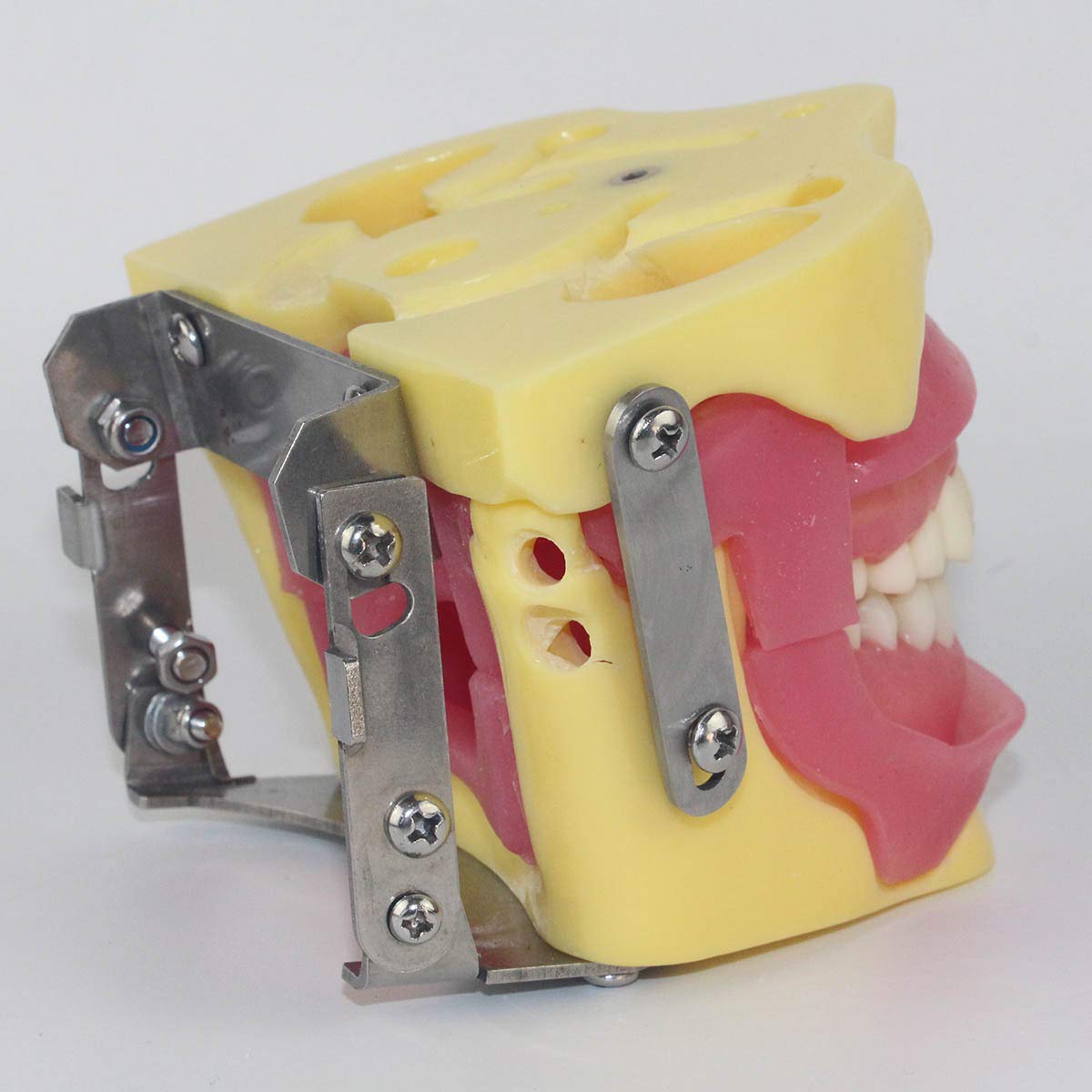 Modèle D'éducation - Modèle Dentaire Dentaire - Tiration De Chirurgie Buccale Anesthésie Opération Extraction Modèle De Démonstration - pour Aider À La Formation Médicale